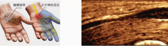 1564035737417016829.png image.png