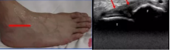 1564035752277058029.png image.png