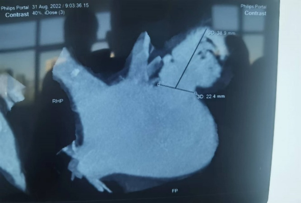 1662626989207018614.jpg 图片 4.jpg